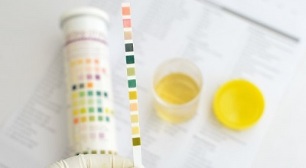 can i smoke before passing urine for analysis